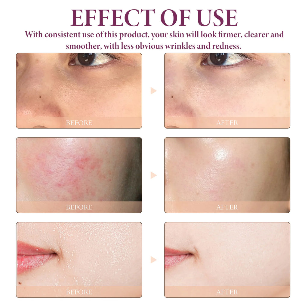 Face Serum Glycolic Acid 10% Toning Solution Fade Fine Lines Firming Improve Facial Dryness Redness Glycolic Acid Repair Essence Oasis Select