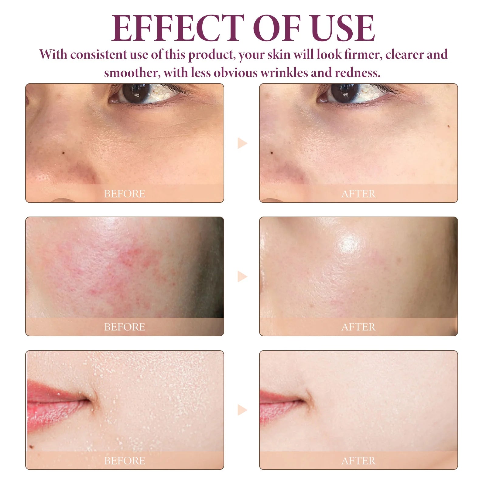 Face Serum Glycolic Acid 10% Toning Solution Fade Fine Lines Firming Improve Facial Dryness Redness Glycolic Acid Repair Essence Oasis Select