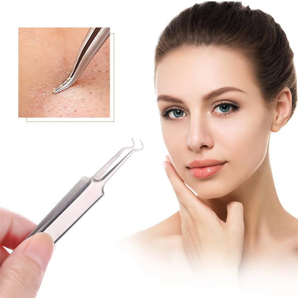 German Ultra-fine No. 5 Cell Pimples Blackhead Clip Tweezers Beauty Salon Special Scraping & Closing Artifact Acne Needle Tools Oasis Select