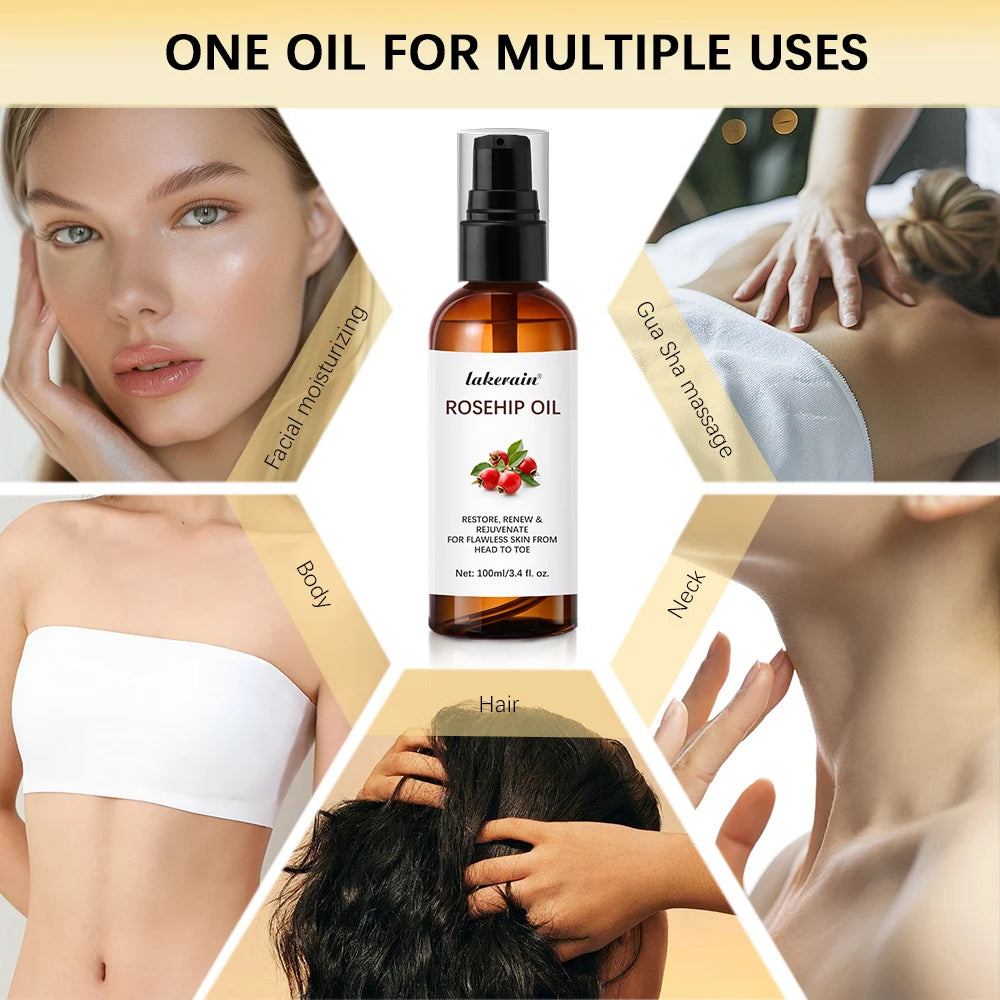 Organic Rosehip Oil Rose Hips Face Oils 30ml Fast-Absorbing Skin Care Moisturizer Face Oil Organic Rosehip Seed Oil Essence Oasis Select