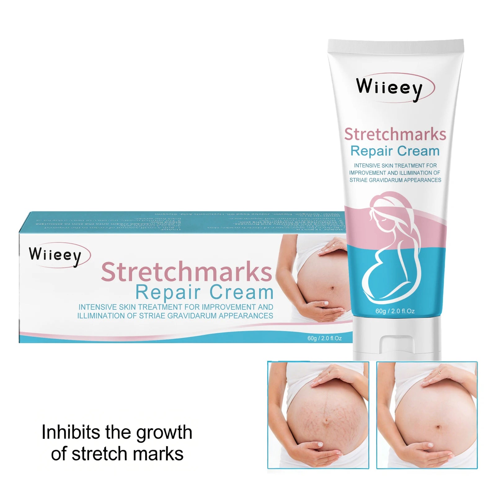 Stretch Mark Repair Cream – Firm, Moisturize & Restore Skin Stretch Mark Cream Oasis Select
