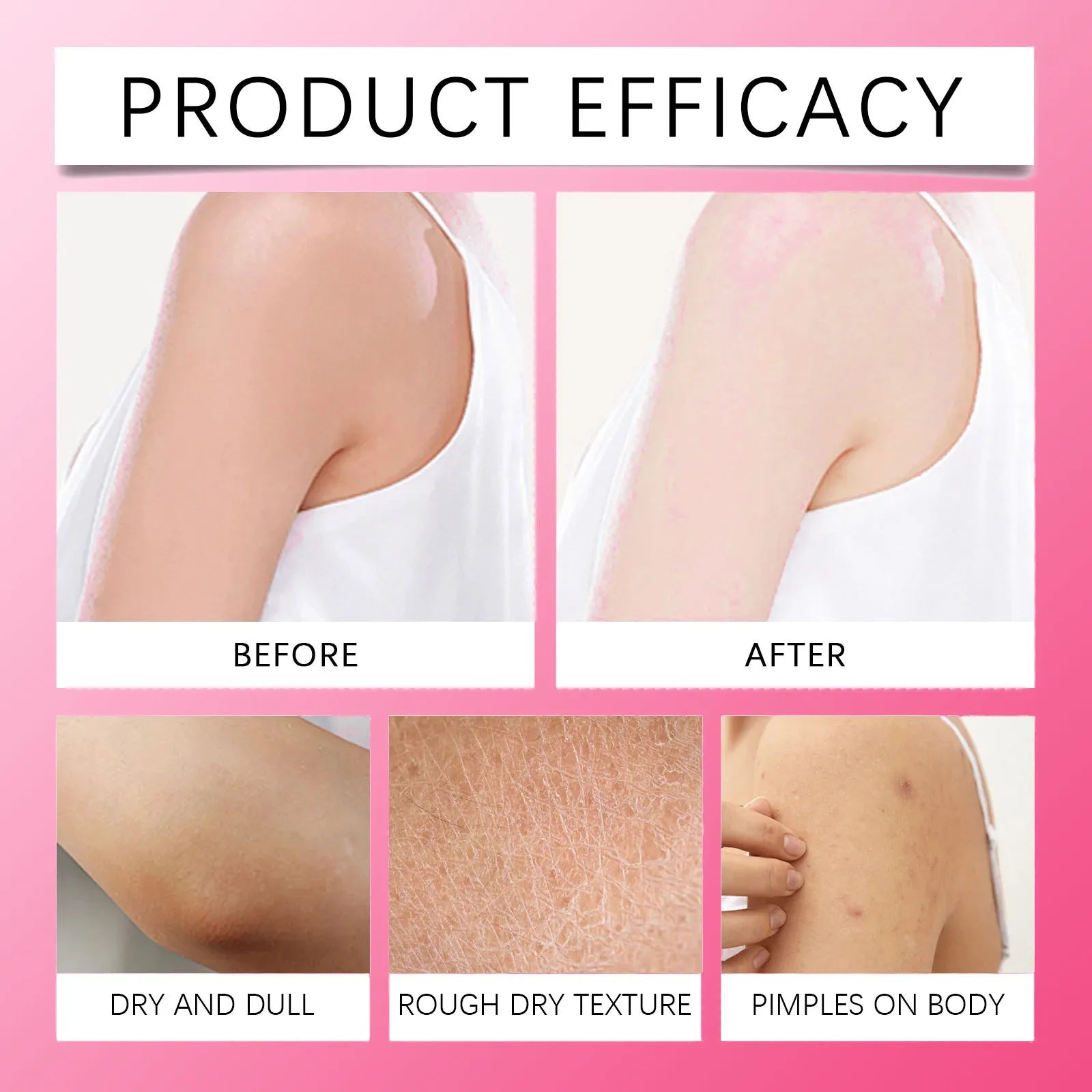 SADOER Brightening Body Cream – Underarm, Thigh & Intimate Skin Brightening Body Cream Oasis Select