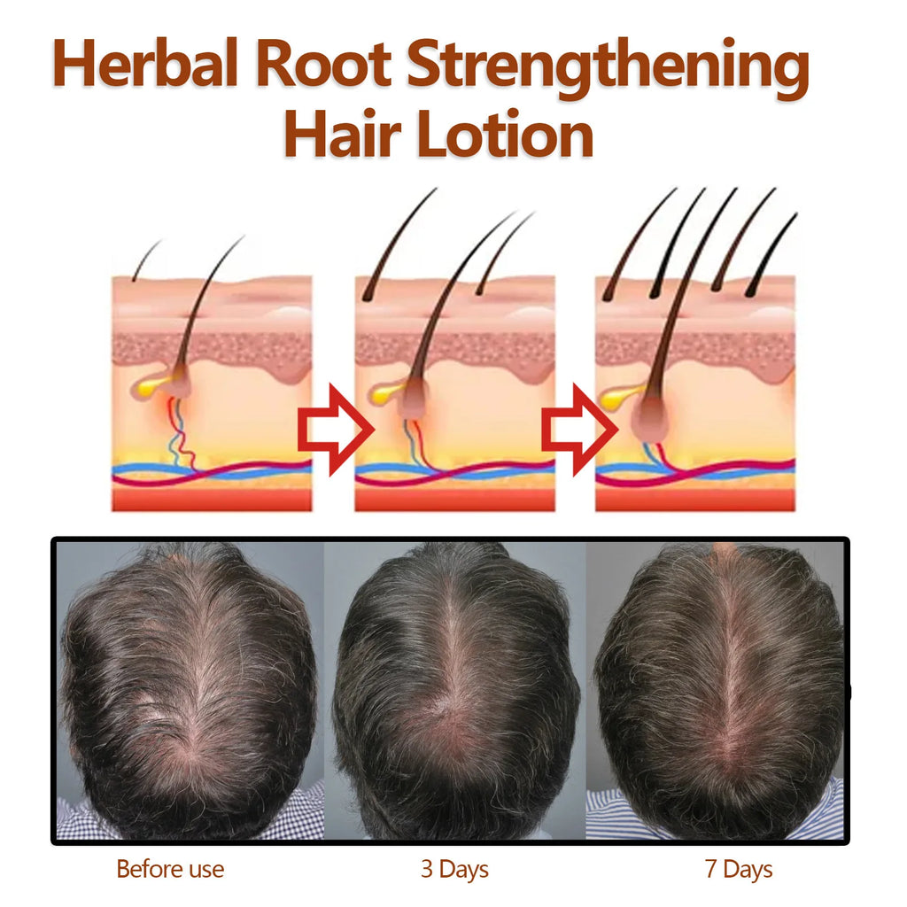 EELHOE Hair Growth Shampoo – Anti-Hair Loss & Scalp Repair Hair Growth Shampoo Oasis Select