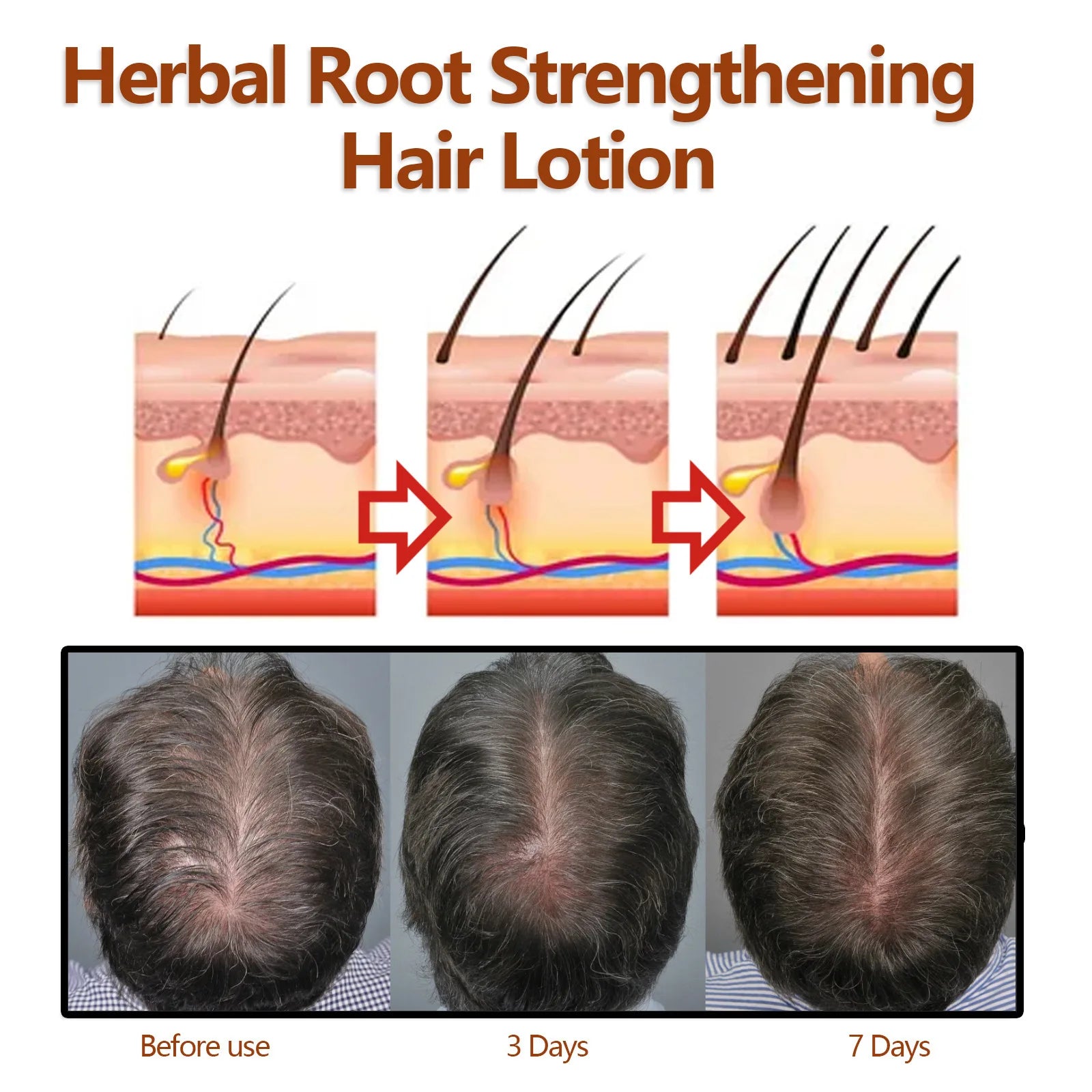EELHOE Hair Growth Shampoo – Anti-Hair Loss & Scalp Repair Hair Growth Shampoo Oasis Select