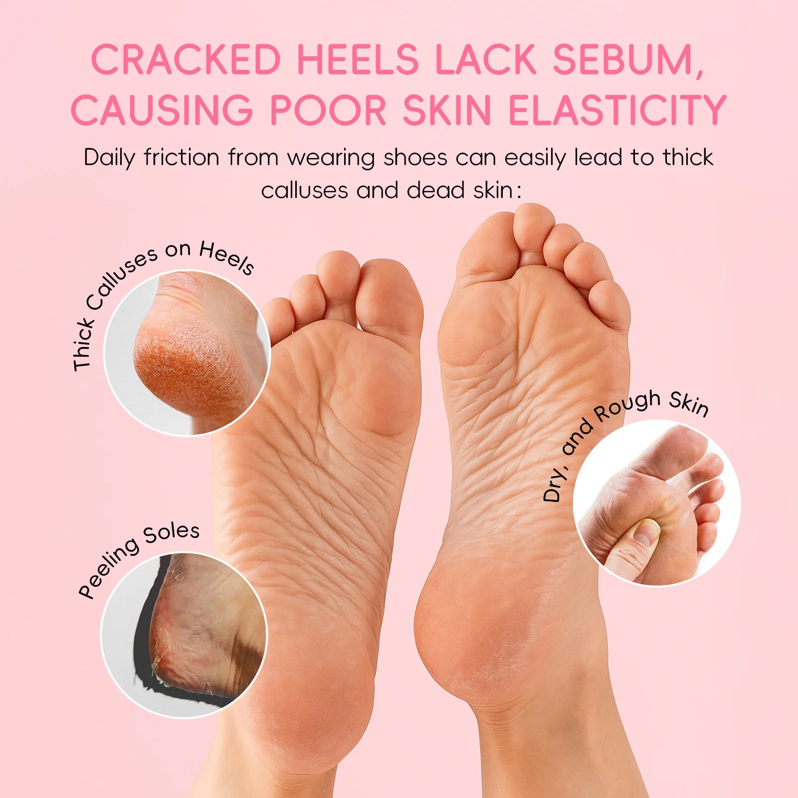 Foot Repair Stick 40g Callus Remover Deep Moisturizing for Cracked Heels Dry Dead Skin Removal Softens Rough Feet Home Care Oasis Select