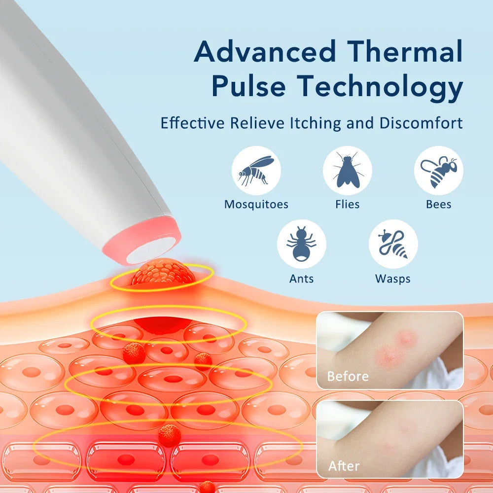 Rechargeable Insect Bite Soothing Pen | 4 Heat Settings