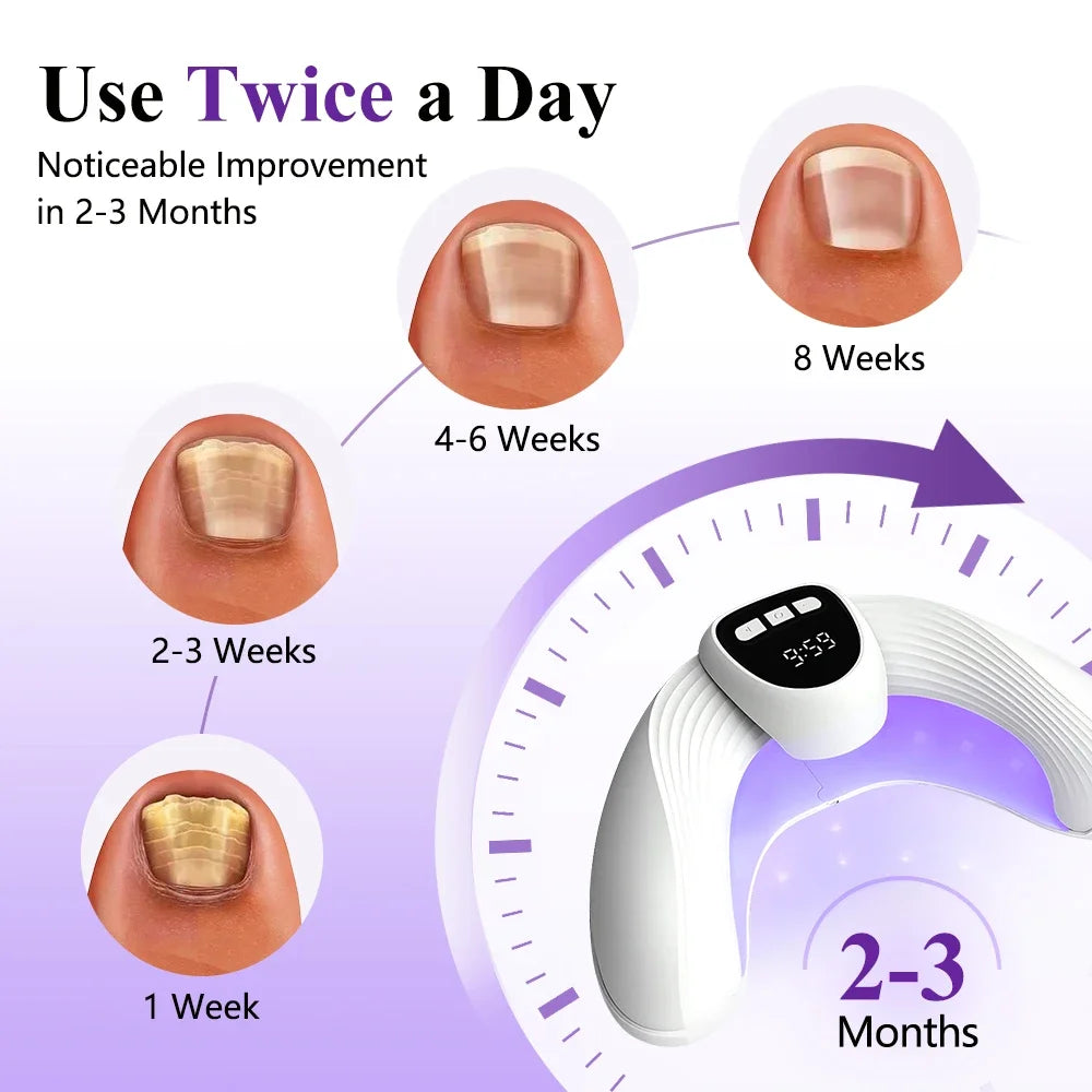 Dual-Wavelength Nail Light Therapy Device | Toenail & Fingernail