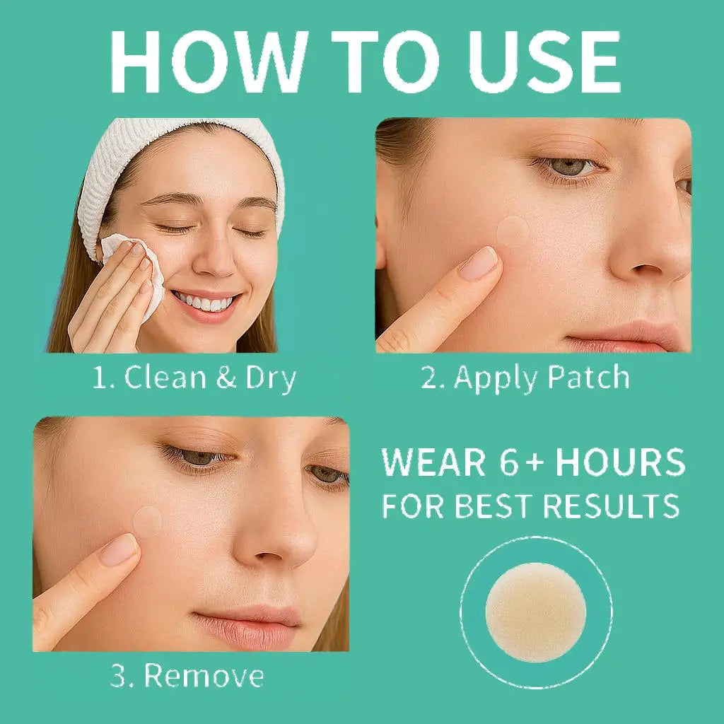 443pcs water-based gel acne patch - removes facial acne, soothes and heals the skin, multiple sizes of oversized acne patches Oasis Select