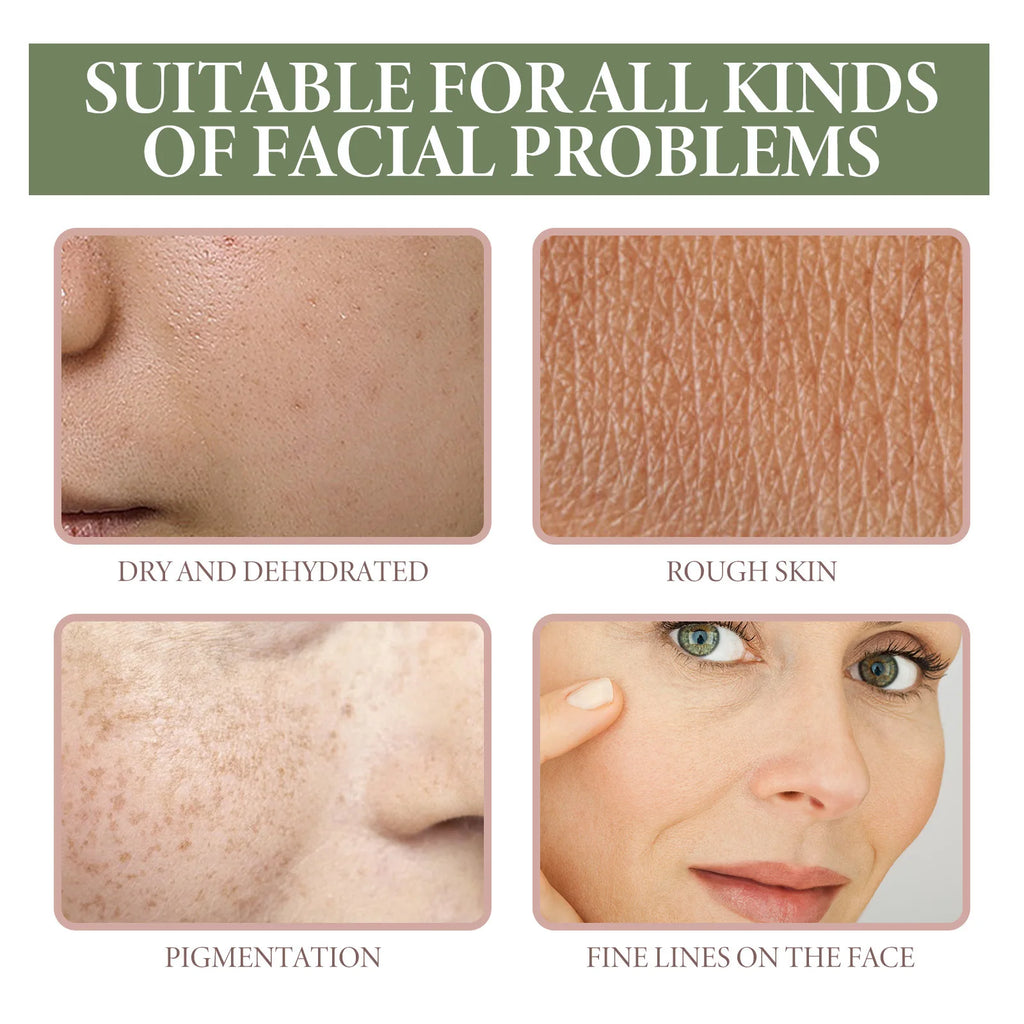 Dark Spots Removal Serum Fade Pigment Chloasma Melanin Brightening Freckle Improves Dull Pore Shrinking Facial Whitening Essence Oasis Select