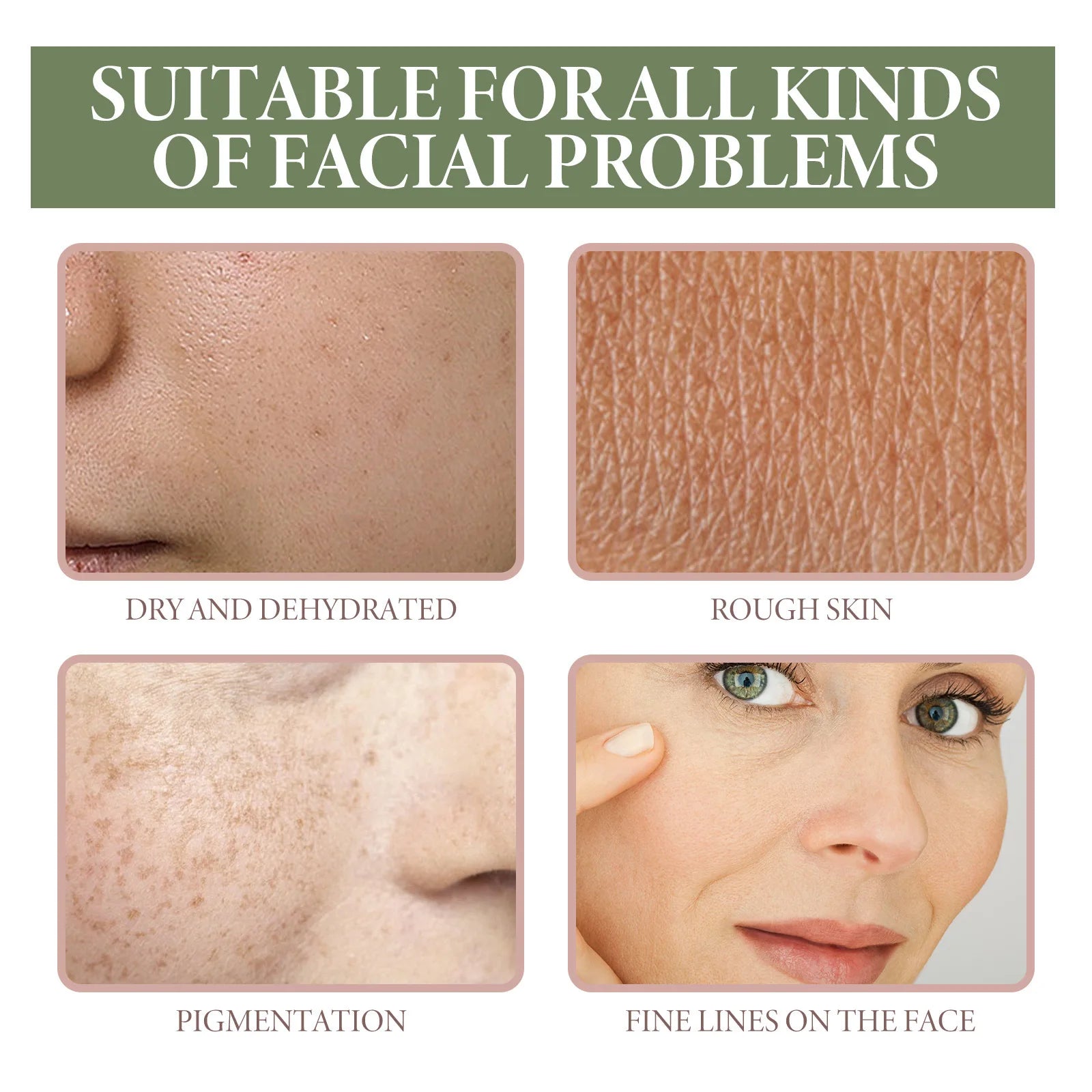 Dark Spots Removal Serum Fade Pigment Chloasma Melanin Brightening Freckle Improves Dull Pore Shrinking Facial Whitening Essence Oasis Select