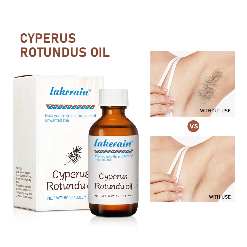 60ml Cyperus Rotundus Oil Nourish the Skin Ingredients are Safe Inhibit Hair Growth Wide Scope of Application Solve Hair Dense P Oasis Select