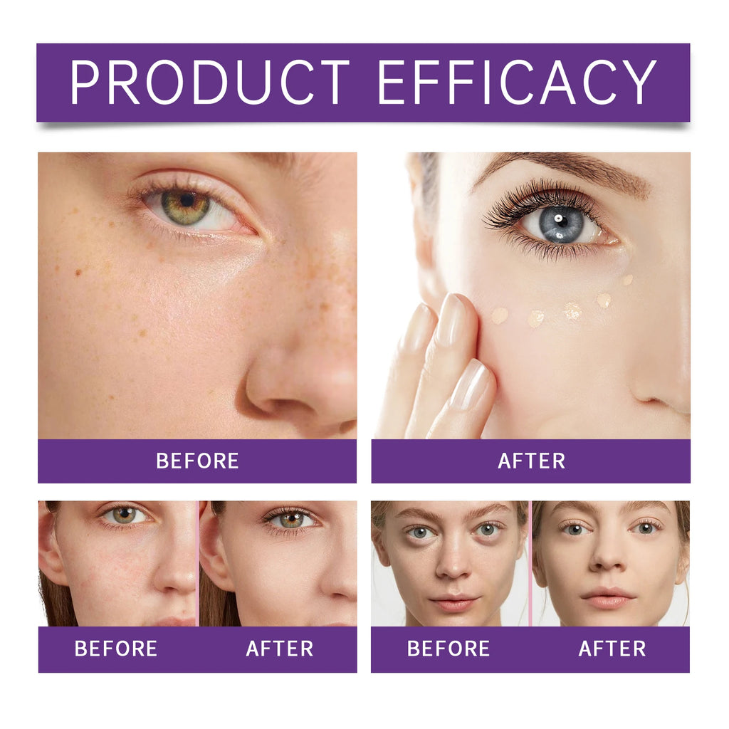 Eelhope Liquid Concealer – Full Coverage Dark Circles & Hydrating Liquid Concealer Oasis Select