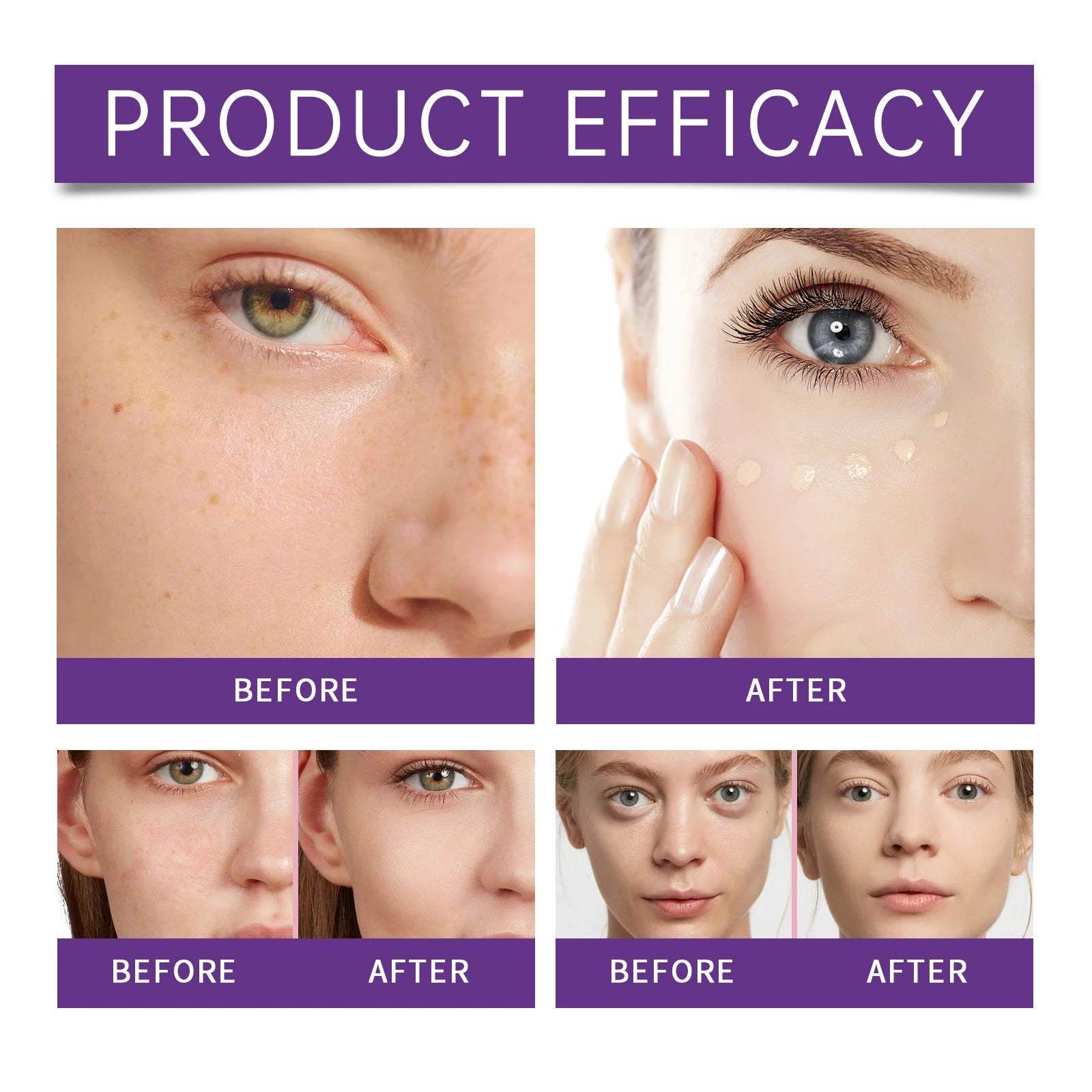 Eelhope Liquid Concealer – Full Coverage Dark Circles & Hydrating Liquid Concealer Oasis Select