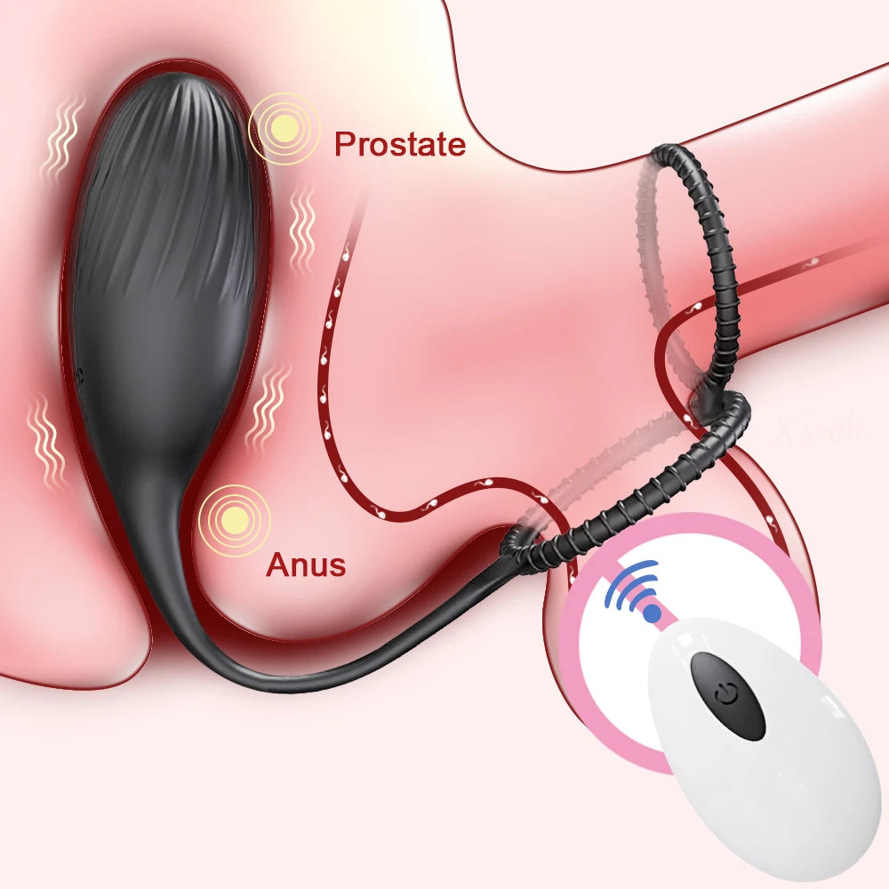Vibrating Prostate Massager for Men Remote Control Butt Plug Anal Vibrator Cock Ring for Gay Anal Plug Sex Toy for Men Women Oasis Select