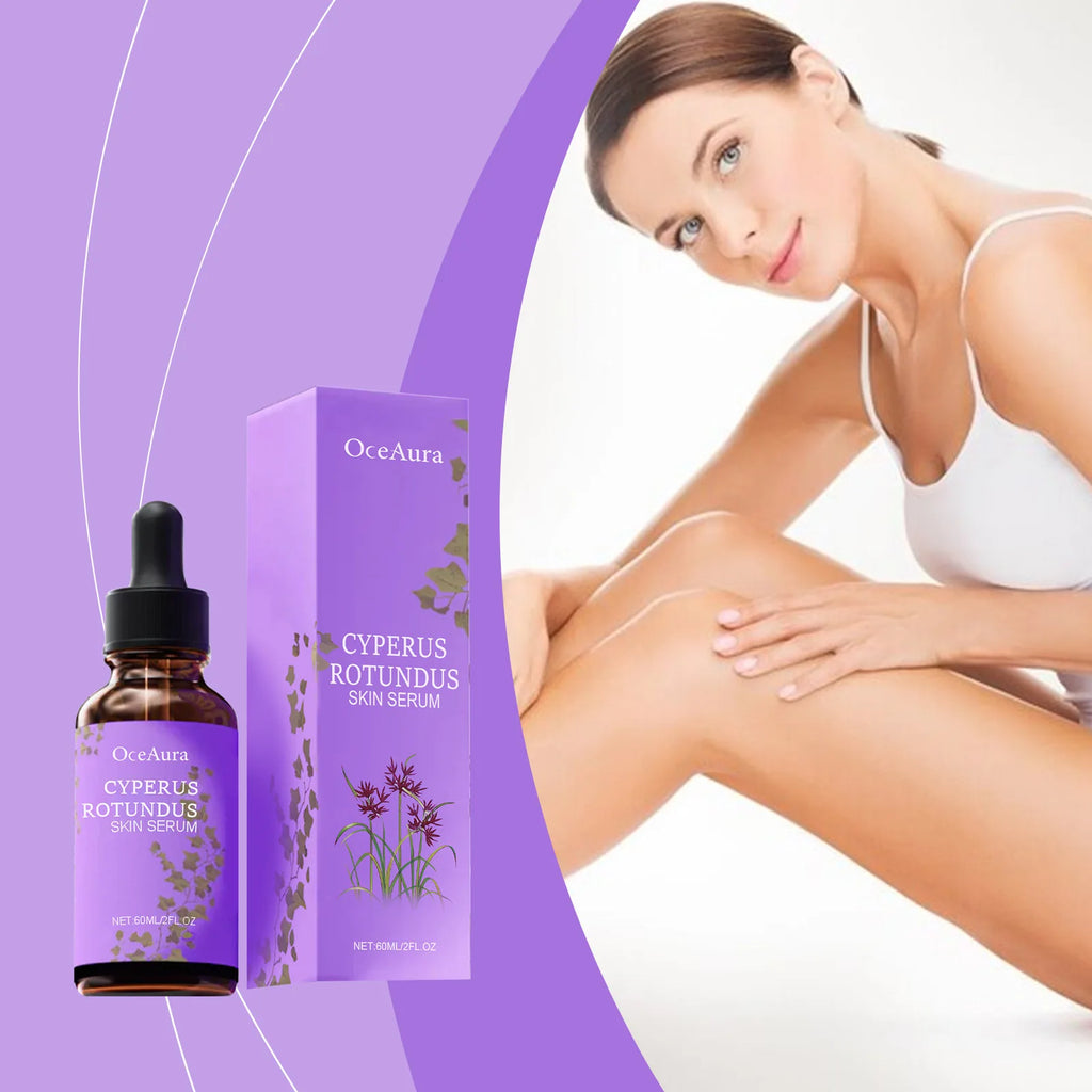 Cyperus Rotundus Serum Hair Growth Inhibitor Soothing Moisturizing Depilatory Refreshing Slowing Reduction Body Hair Growing Oil Oasis Select