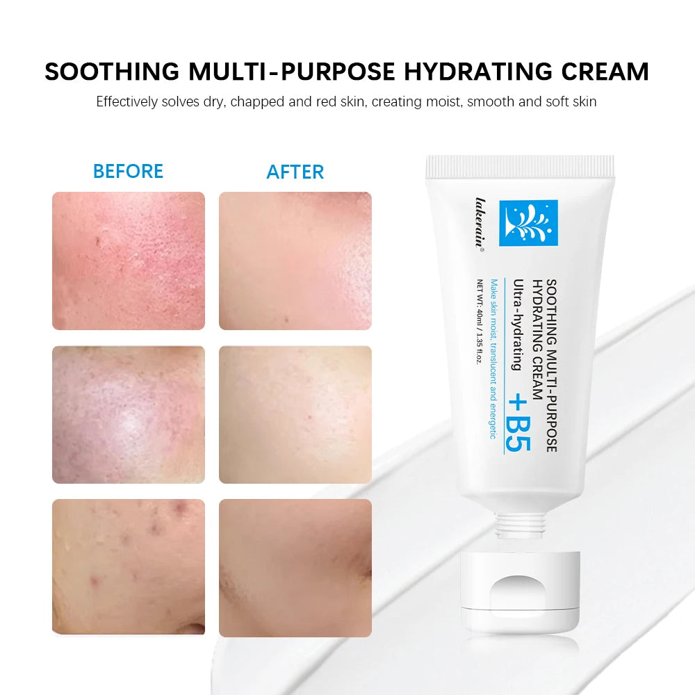 Soothing Multi-Purpose Hydrating Cream Reduces Redness Daily Helps Relieve Rough Cracked Skin Deep Skin Care Oasis Select