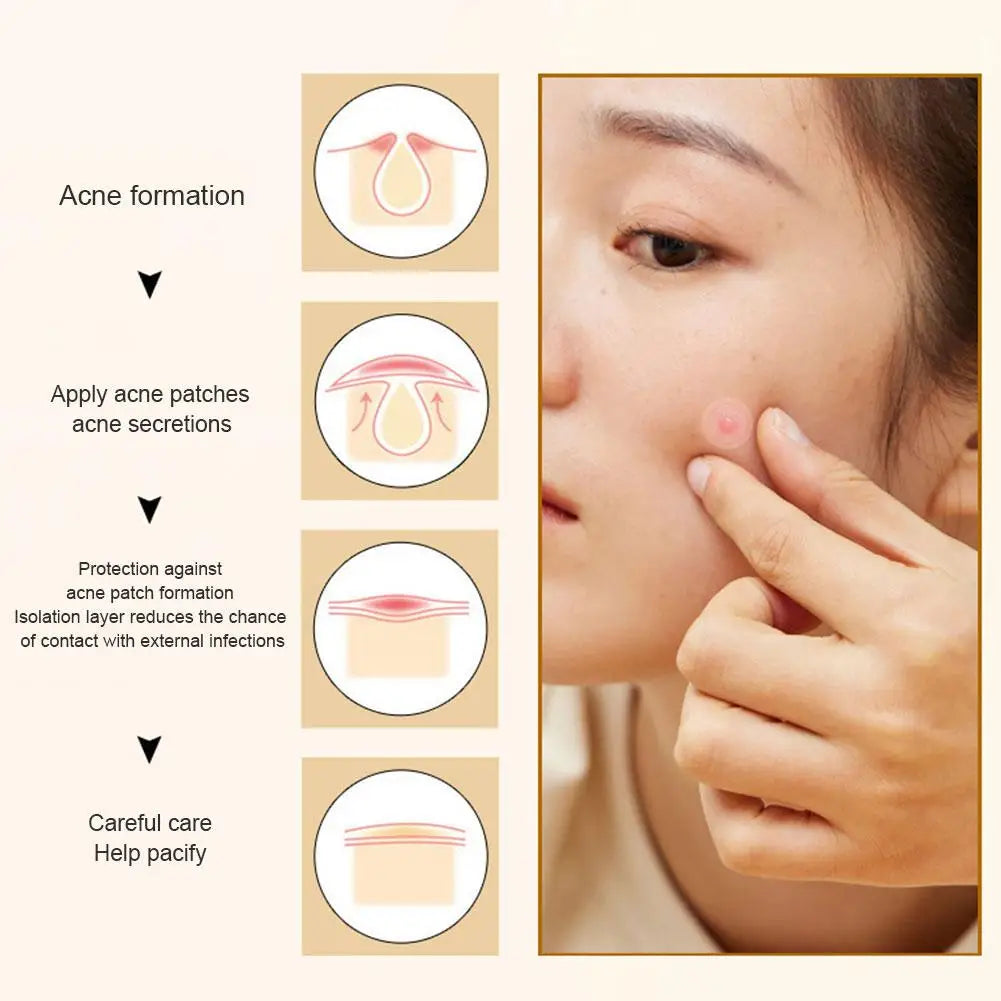 35/40Pcs Colorful Cute Star Heart Shaped Acne Treatment Sticker Invisible Acne Cover Pimple Patch Skin Care Oasis Select