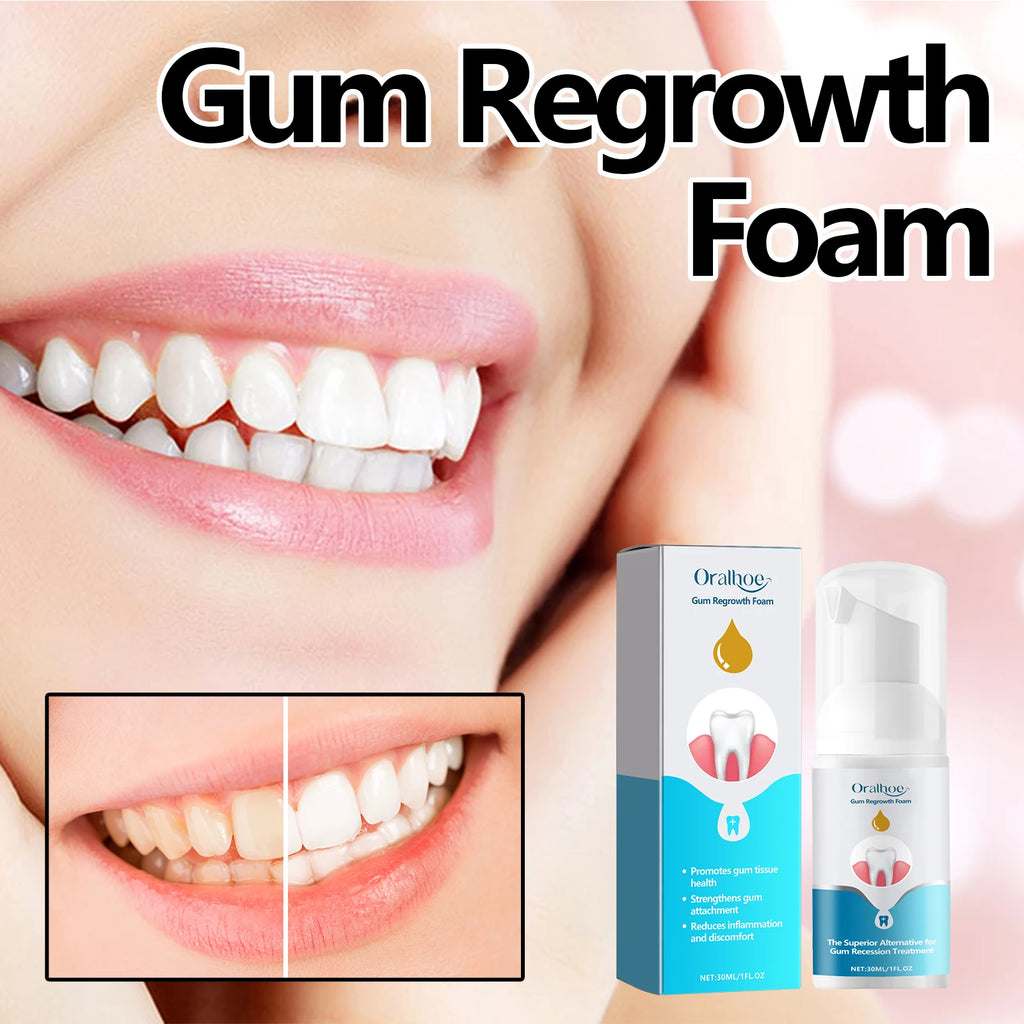 Gum Regrowth Foam Repair Gingival Remove Yellow Stain Relieve Dental Decay Whitening Teeth Oral Cleaning Protect Gum Care 30ml Oasis Select