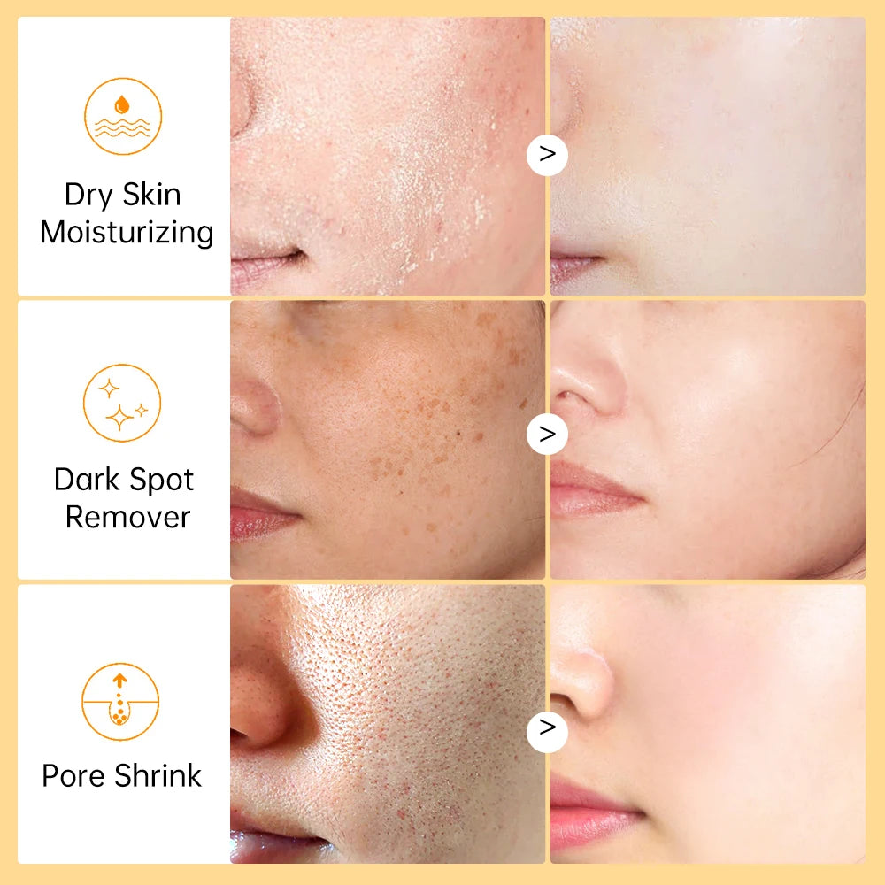 Vitamin C Face Whitening Serum Deep Moisturizing Removal Dark Spots Hyaluronic Acid Essence Anti Aging Facial Serum Skin Care Oasis Select