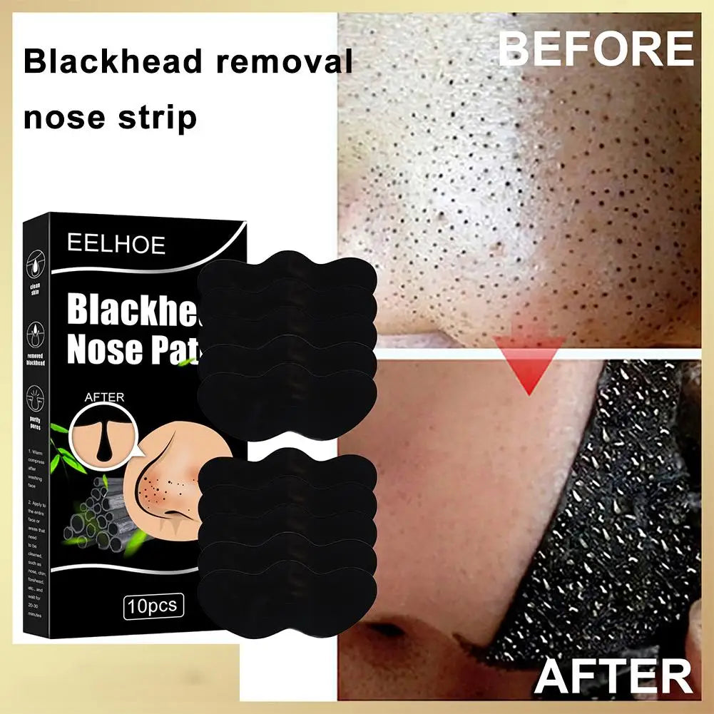10pcs/Box Blackhead Remover Nose Strips Nasal Patch Deep Cleaning Shrink Pores Acne Treatment Nose Blackhead Mask Strip Skincare Oasis Select