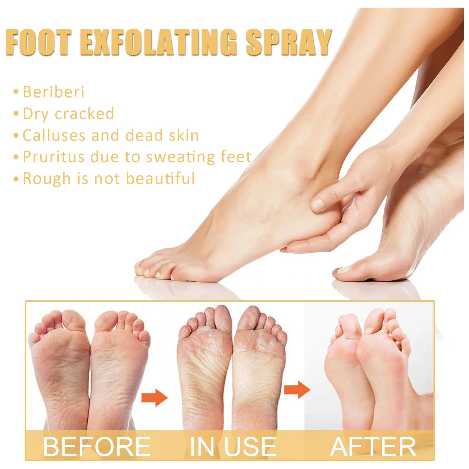 Foot Callus Remover Spray Quickly Soften Calluses Exfoliation Dry Feet Skin Hydrating clean Dead repair Skin cuticles Foot Care Oasis Select