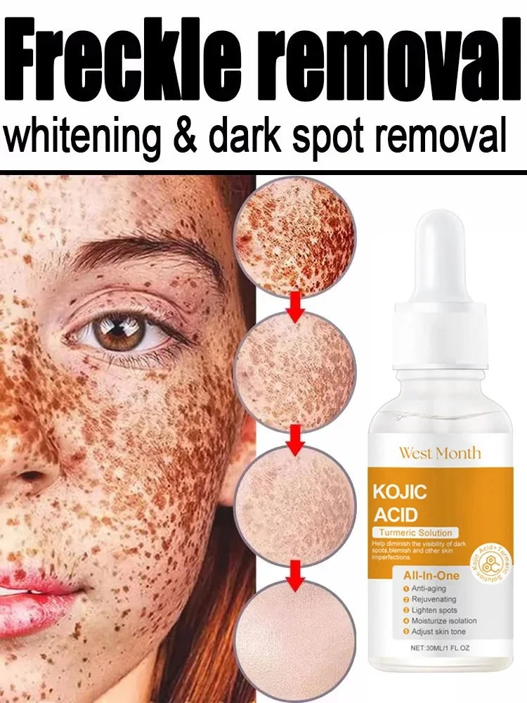 Kojic Acid Brightening Serum – Dark Spot & Tone Corrector