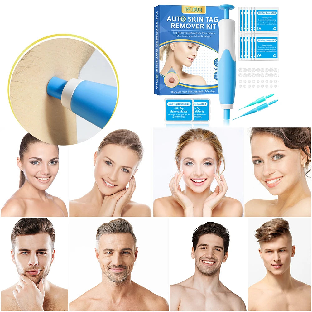 2-in-1 Skin Tag Remover Kit – Painless Wart & Mole Tool Skin Tag Remover Oasis Select