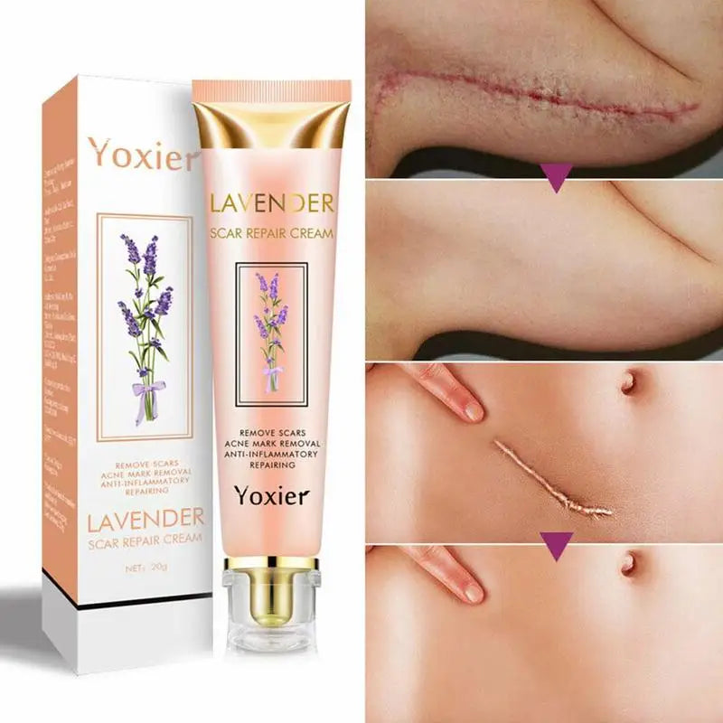 Lavender Scar Repair Cream – Fade Acne Marks & Smooth Skin Scar Repair Cream Oasis Select