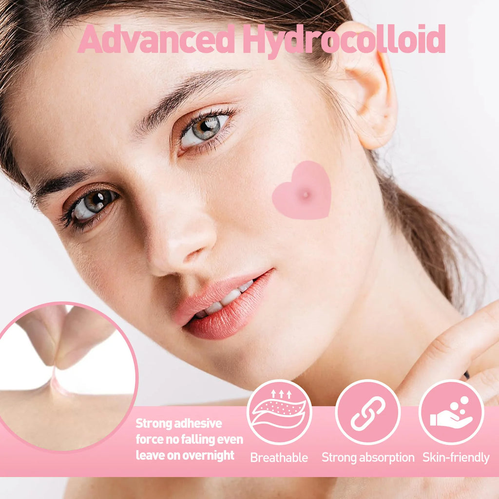 Rose red love design hydrogel acne patch, 24/144 pieces per box, waterproof, breathable, suitable for use day and night Oasis Select