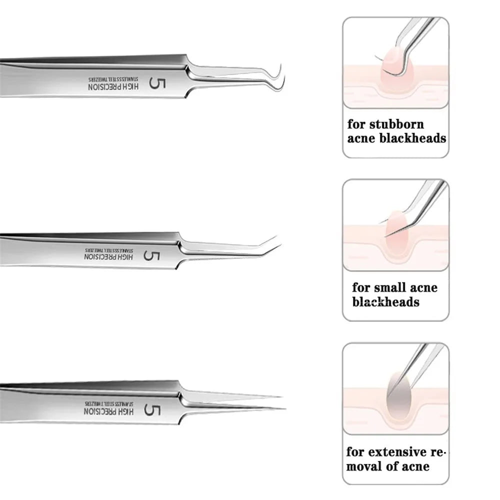 German Ultra-fine No. 5 Cell Pimples Blackhead Clip Tweezers Beauty Salon Special Scraping & Closing Artifact Acne Needle Tools Oasis Select