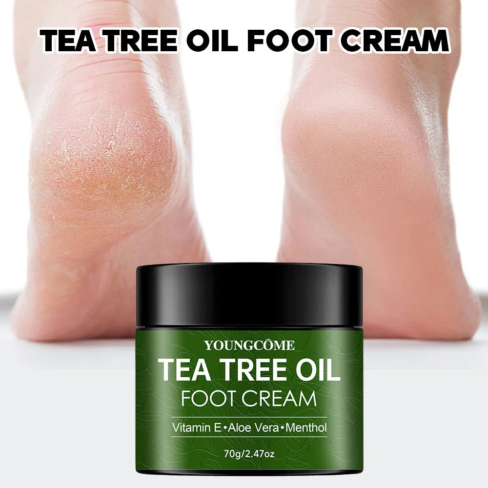 YOUNGCOME Tea Tree Foot Cream – Soften & Hydrate Rough Heels