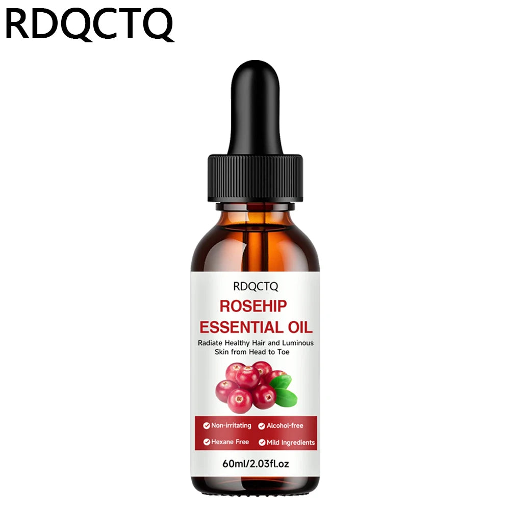 Rose Hip Oil for Hair & Skin - Pure Natural Moisturizing Essential Oil, Alcohol-Free, Nourishing Care for Healthy Look Oasis Select
