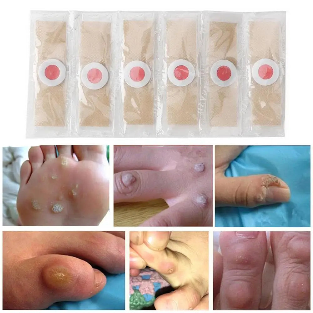 6Pcs Foot Toe Corn And Callus Removers Pads Self-Stick Adhesive Foot Cushion Corn Callus Remover Cushions Foot Care Patches Oasis Select