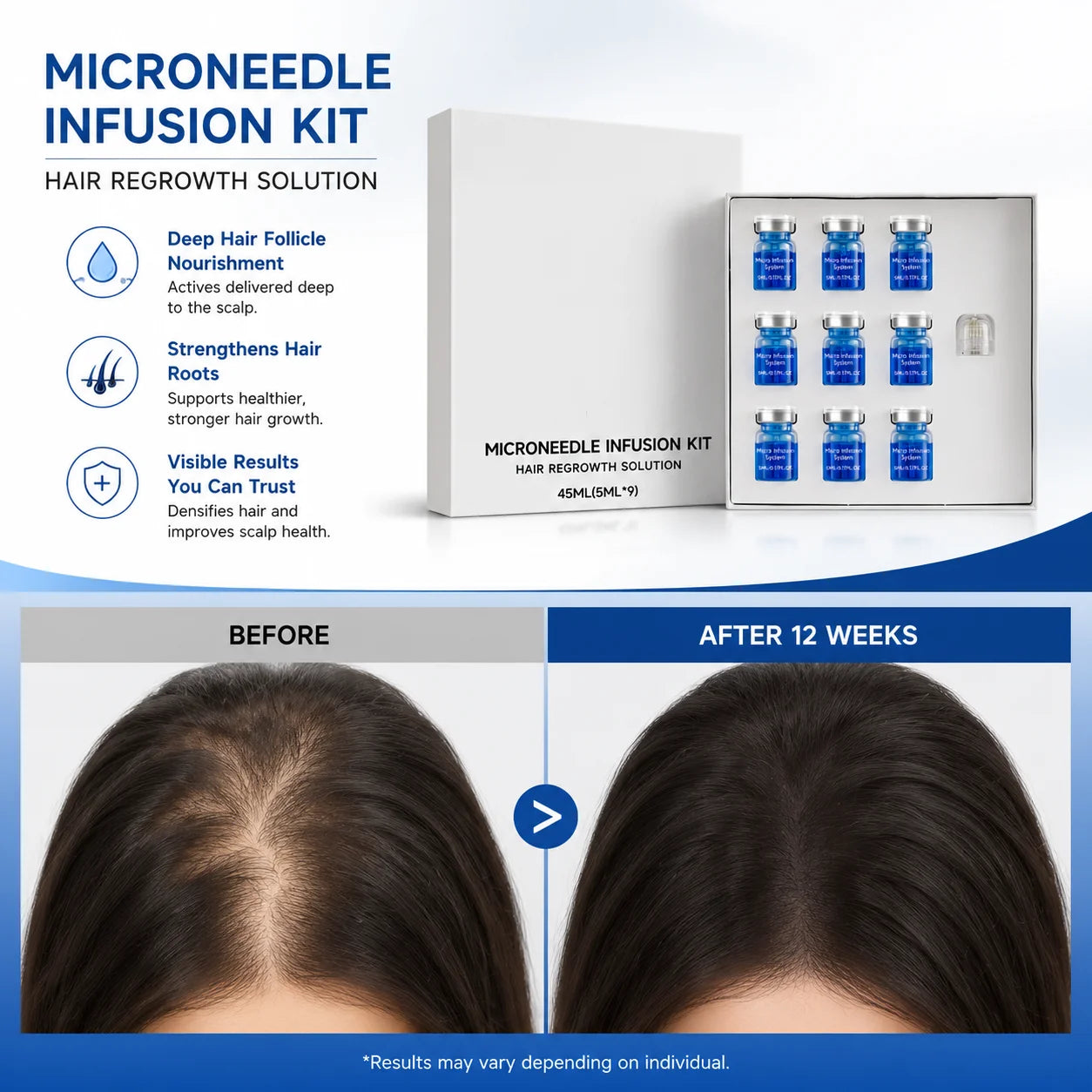 Microneedle Hair Regrowth Kit Solution Scalp Nourishing Serum For Hair Health Maintenance Needle Head Use Scalp Care Kit Oasis Select