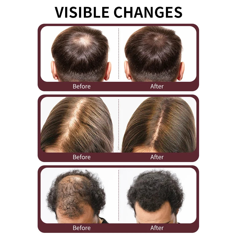 Batana Oil Shampoo for Hair Growth & Hair Loss Reduction Hair Growth Shampoo Oasis Select