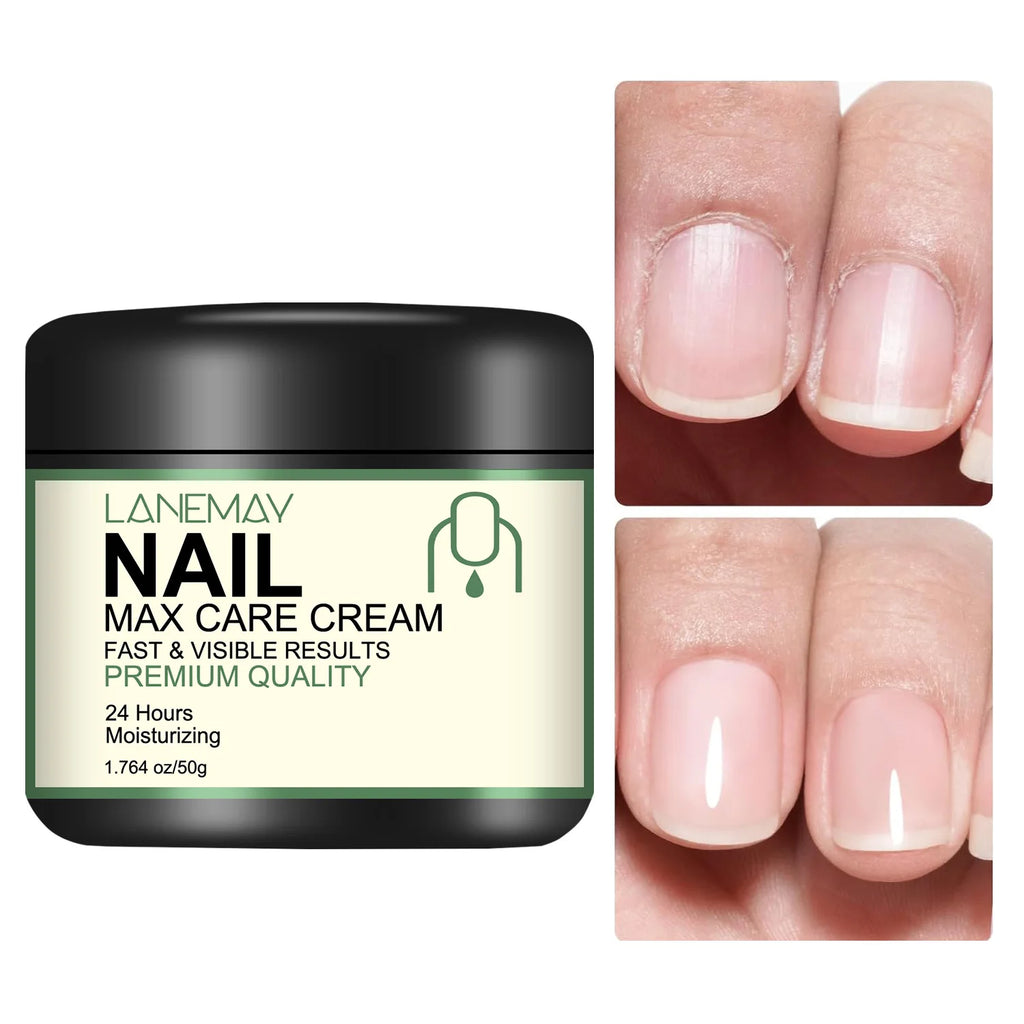 Nail Max Care Cream – Bee Venom & Vitamin C | 50g