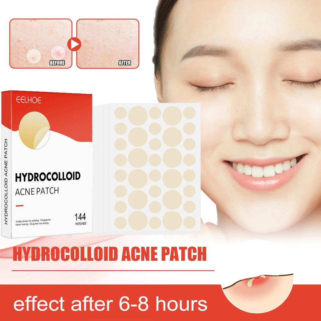 Hydrocolloid Acne Patches 2 Sizes Invisible Makeup-Friendly Face Care Acne Pimple Patch Breathable for Comedones Spot Treatment Oasis Select