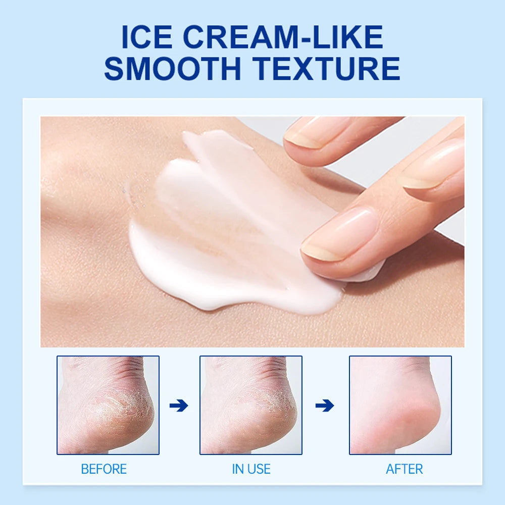 Urea Foot Cream Moisturizing Exfoliating Hand Feet Dead Skin Removal Anti Peeling Heels Repair Mask Foot Skin Care Products Oasis Select