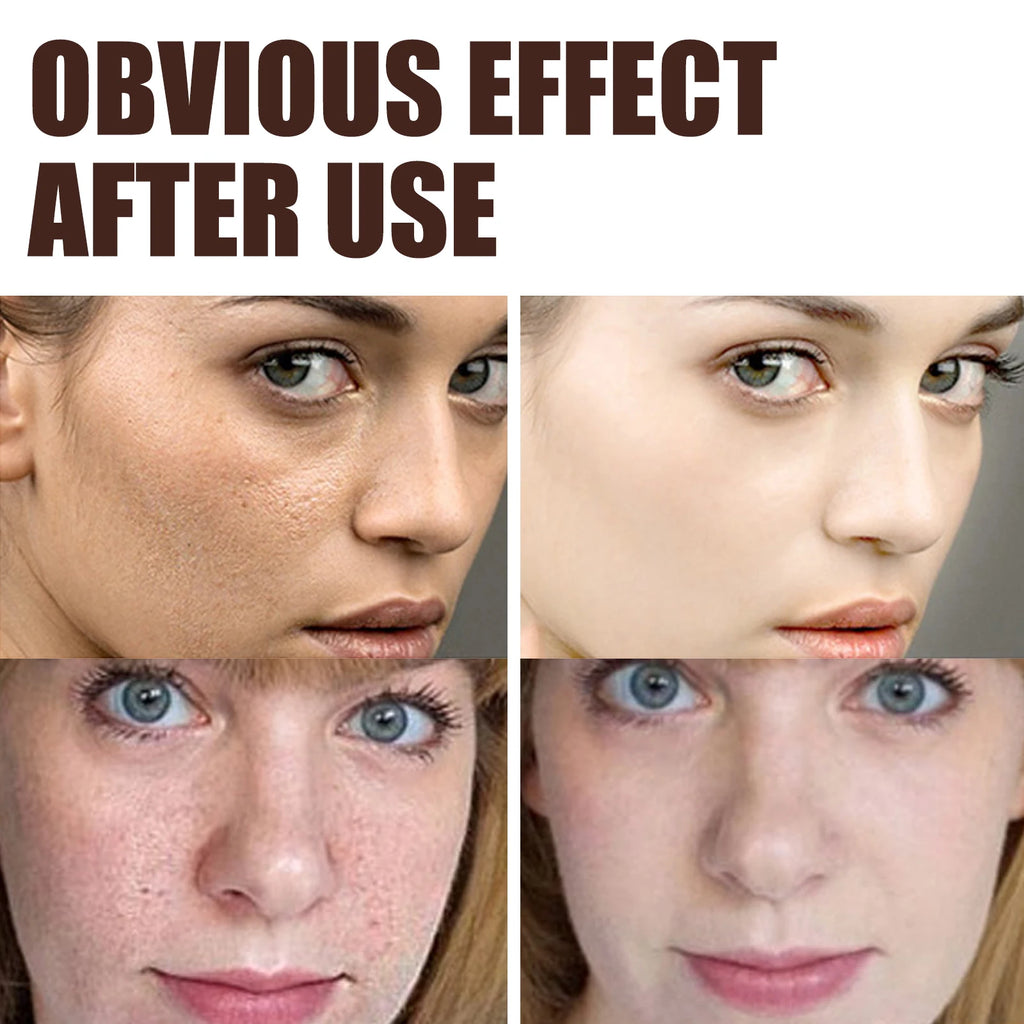 Eelhoe Double Retinol Face Cream – Anti-Aging & Brightening Anti-Aging Face Cream Oasis Select
