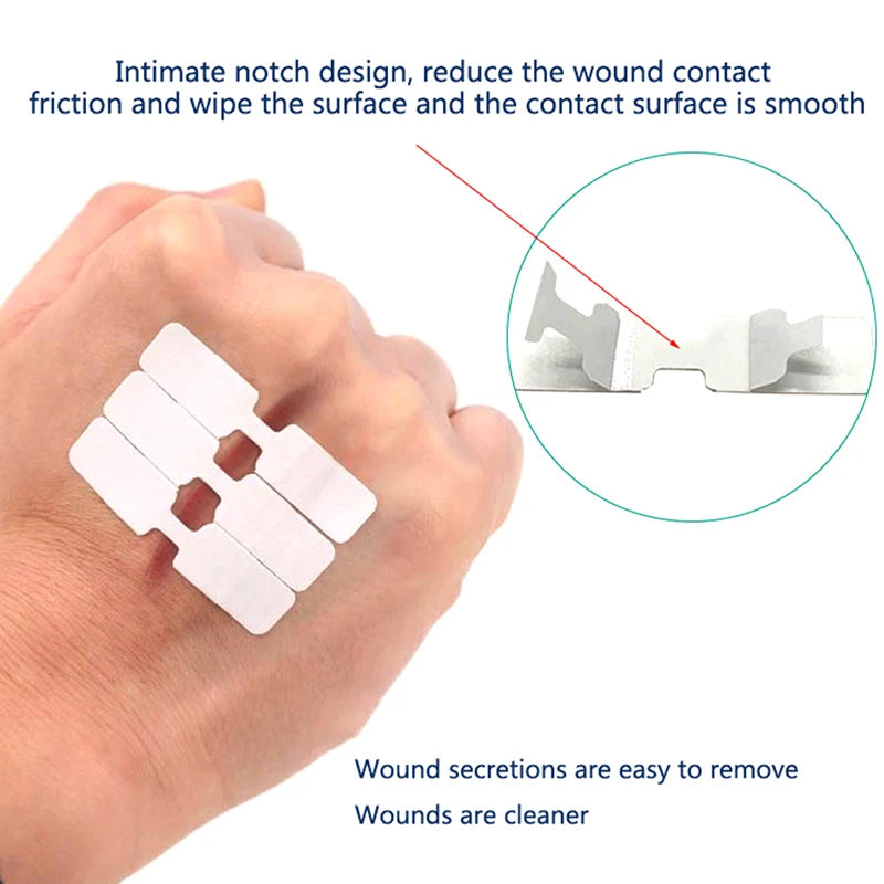 Emergency Wound Closure Zip Stitch Sutures Bandaids Repair Wounds Without Stitches For Outdoor Activities Quick Clot Wound Oasis Select