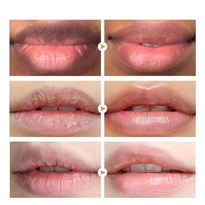 Brightening Lip Balm – Exfoliating & Moisturizing Treatment