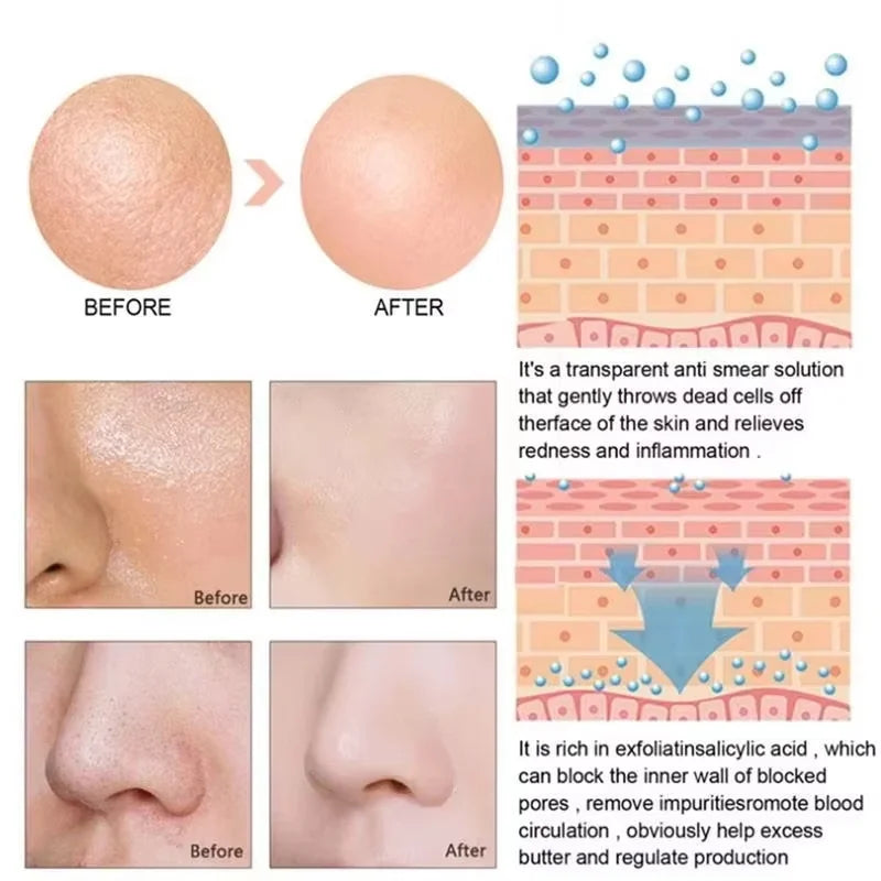 Pore Minimizing Face Serum – Oil Control & Blackhead Care Pore Minimizing Serum Oasis Select