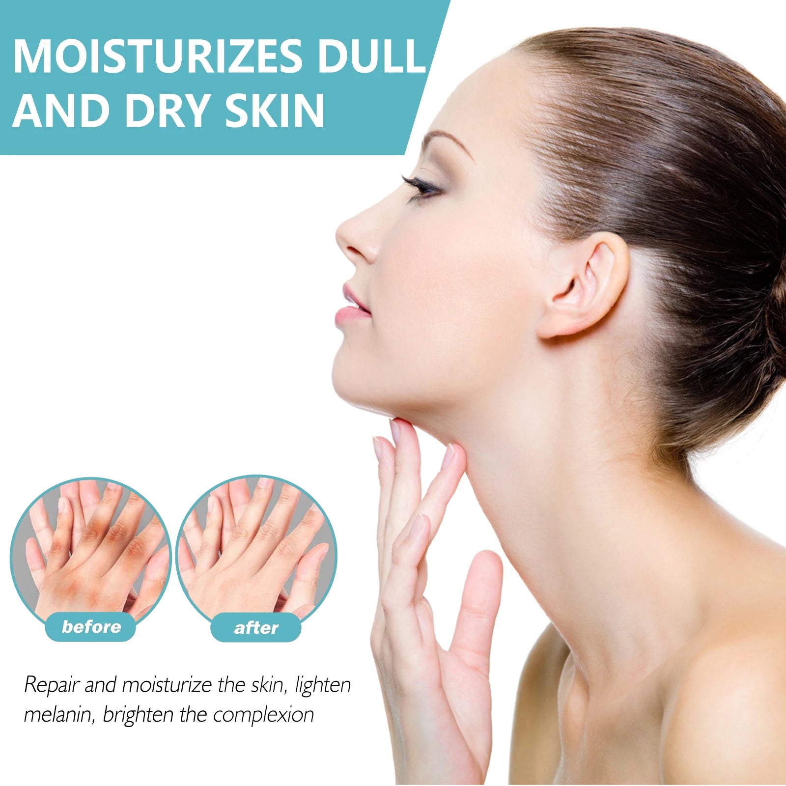 Acanthosis Nigricans Repair Cream – Dark Spot Brightening
