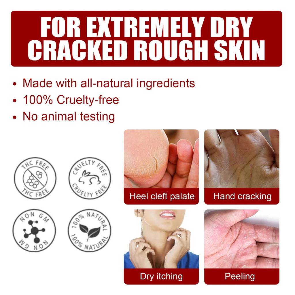 AHA Exfoliating Foot Mask – Dead Skin & Cracked Heel Peel Exfoliating Foot Mask Oasis Select