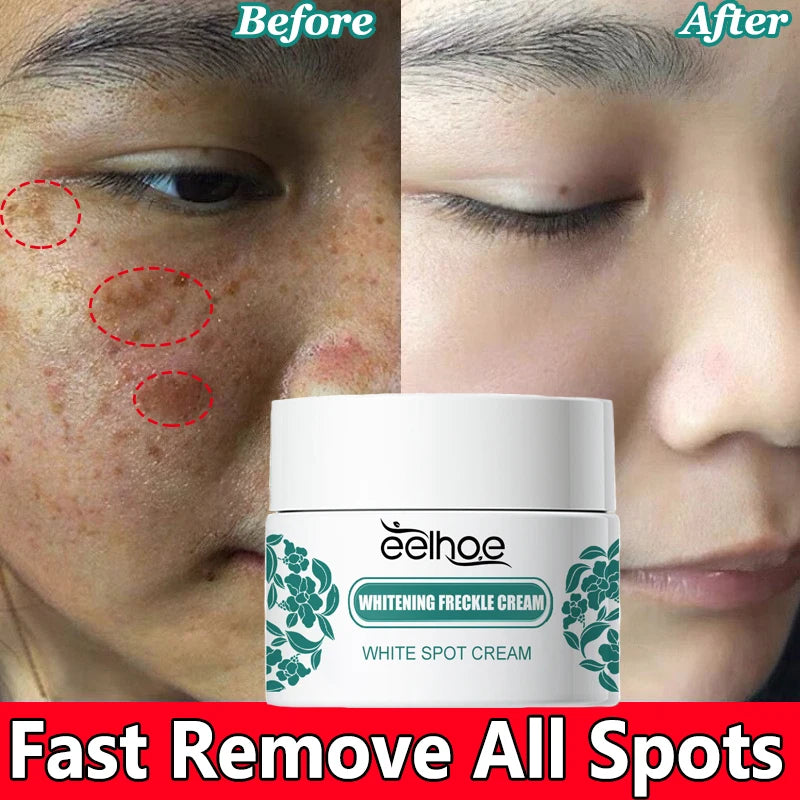 Eelhoe Vitamin C Face Cream – Dark Spot & Brightening Corrector