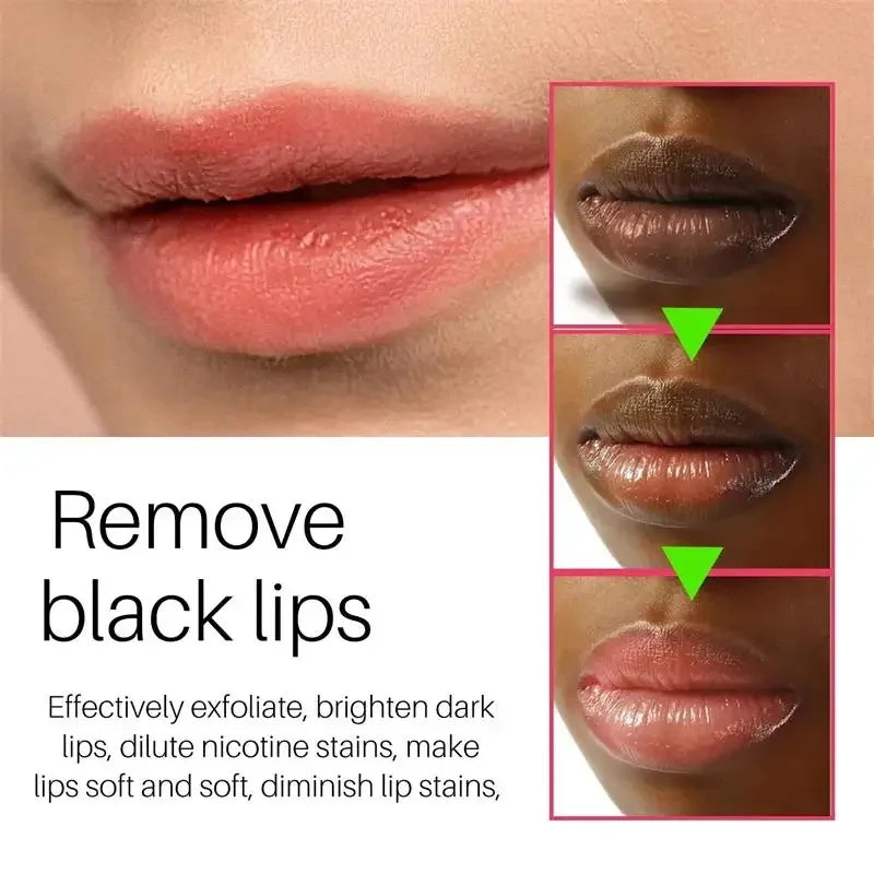 Remove Dark Smoke Lip Balm Lightening Melanin Bleaching Gloss Oil Lips Pink Lipstick Exfoliating Fade Lip Lines Korean Cosmetics Oasis Select