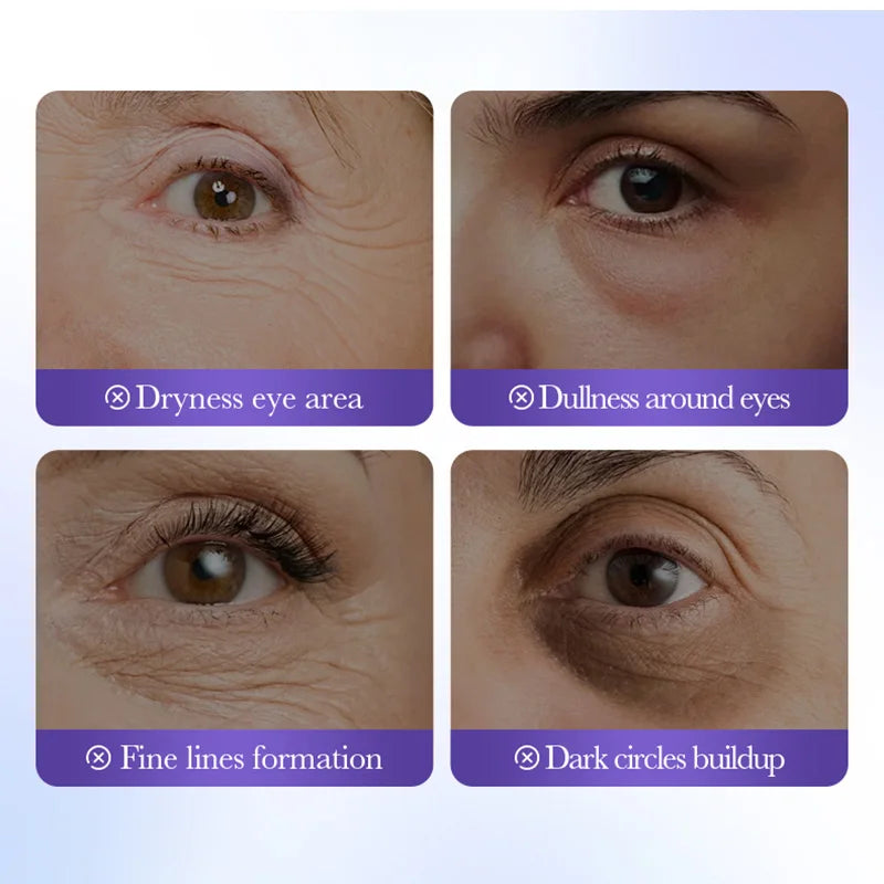 BIOAQUA Retinol Collagen Eye Mask 80pcs – Dark Circles & Anti-Aging Eye Mask Patches Oasis Select