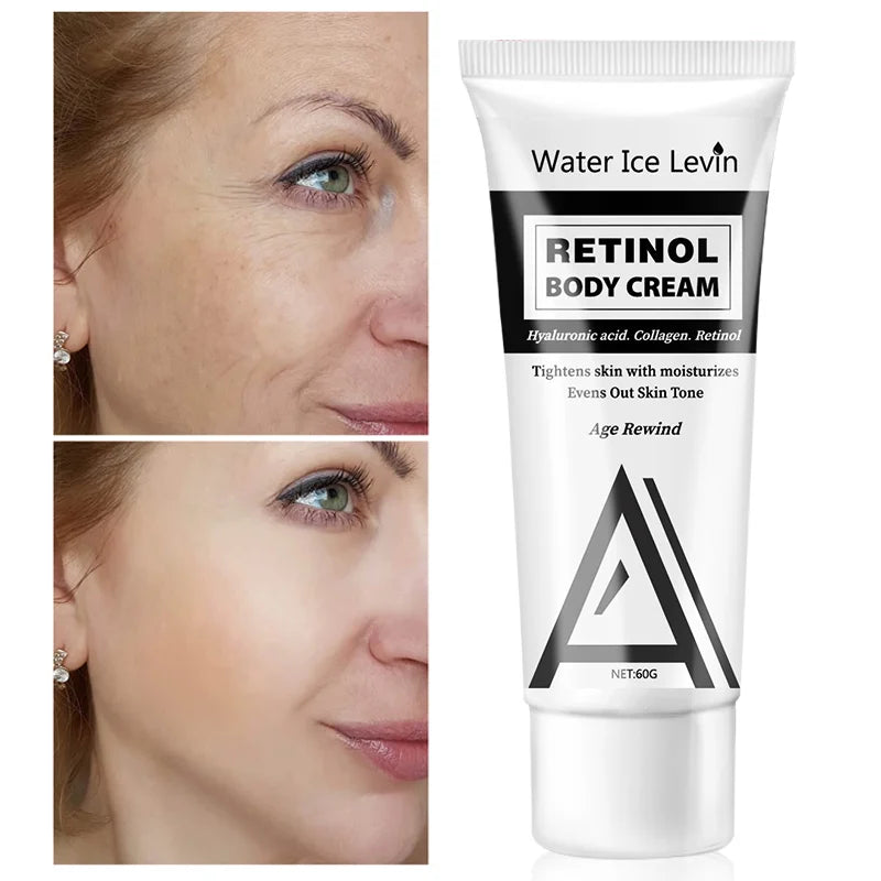 Retinol Body Lotion – Firming Moisturizer & Wrinkle Cream Firming Body Lotion Oasis Select