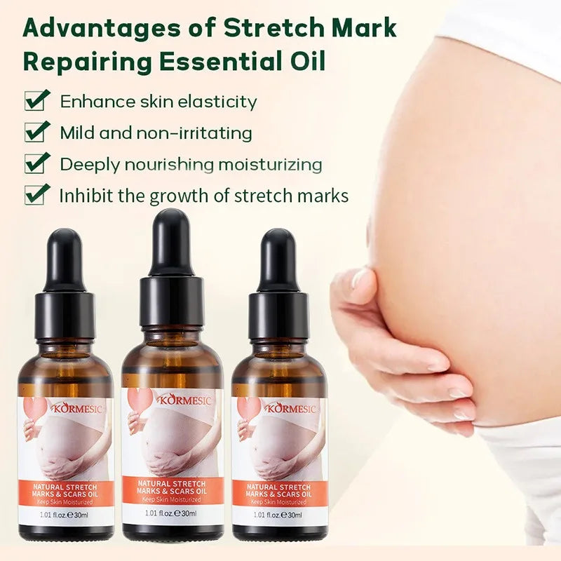 BIOAOUA Stretch Mark Oil Serum – Improve Skin Elasticity