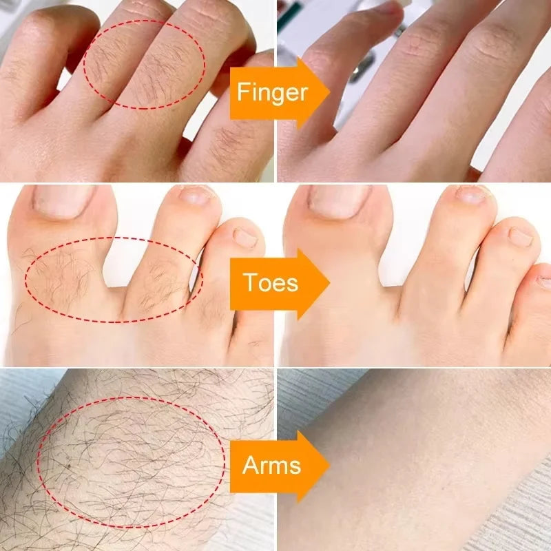 3 Minutes Fast Hair Removal Cream Painless Hair Growth Inhibitor Lip Face Arm Armpit Leg Permanent Depilatory for Men Women Care Oasis Select